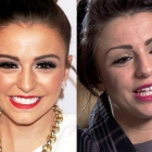  Cher Lloyd’s American transformation is complete as she replaces gapped front teeth with a Hollywood smile