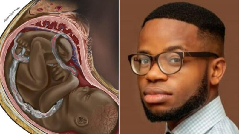  A Medical student went viral after Posting Illustration of Black Baby in Womb