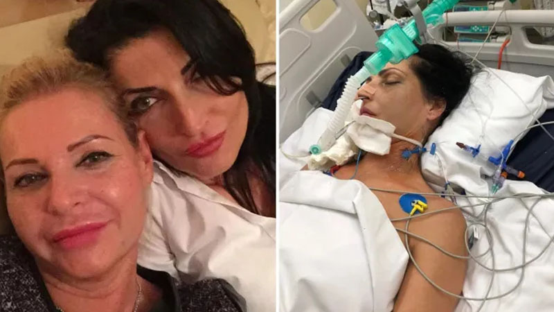  Cosmetic surgery puts a woman in a coma from which she will never recover