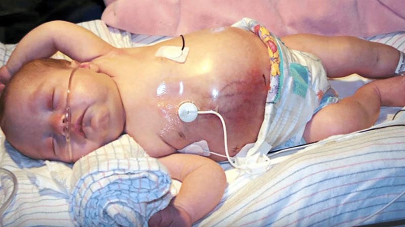  Doctors Notice Something Strange in Infant’s Tummy and Realize It’s Growing In Her Twin Too!