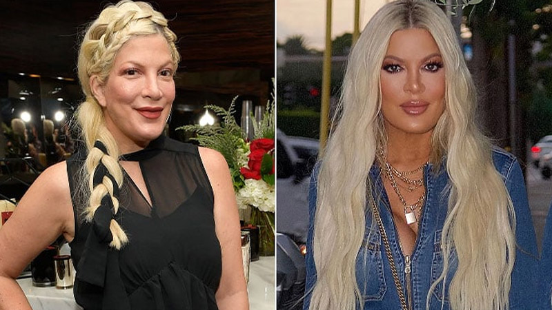  Tori Spelling faces accusations of undergoing fillers amid financial struggles