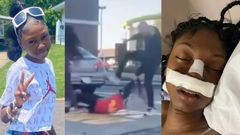  Teen McDonald’s Worker Left With Fractured Skull After Customer Stomps On Her Head