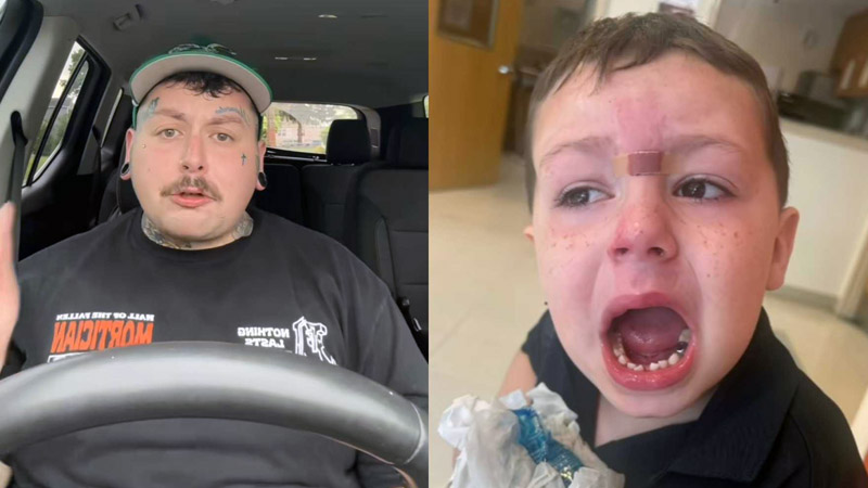  “What Would You Do If You Were Me?” Dad Begs TikTok for Help After His 5-Year-Old Son Was Brutally Attacked at School